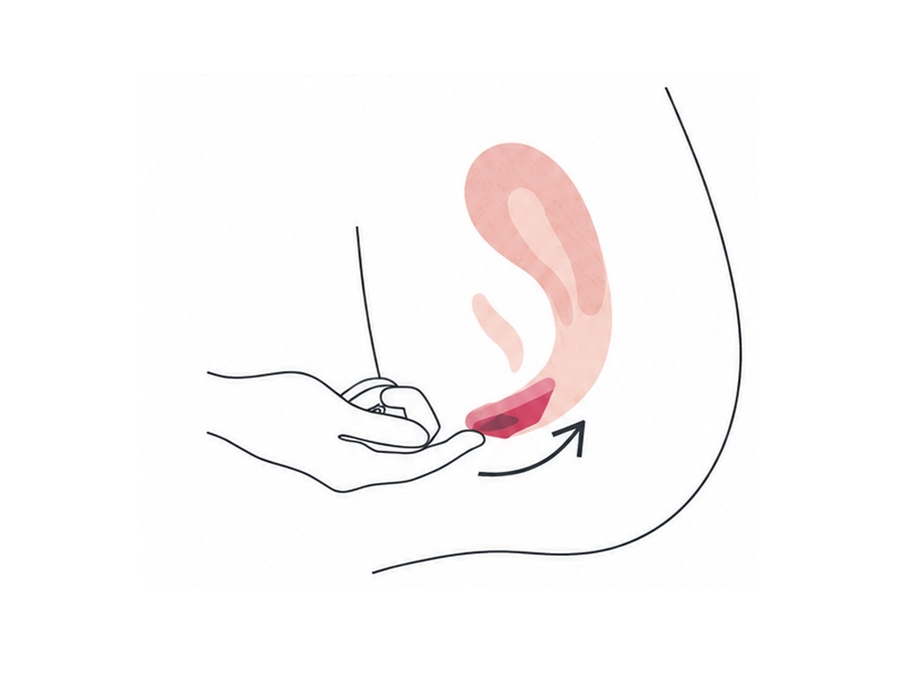 Insert the Janell menstrual disc