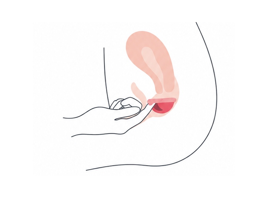 Tuck the Janell menstrual disc into place
